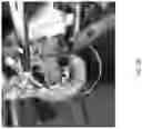 Fig. 18 - Valve translocation device and method for the treatment of functional valve regurgitation