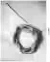 Fig. 37 - Valve translocation device and method for the treatment of functional valve regurgitation