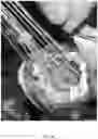 Fig. 43 - Valve translocation device and method for the treatment of functional valve regurgitation