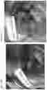 Fig. 56 - Valve translocation device and method for the treatment of functional valve regurgitation