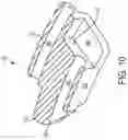 Fig. 09 - Methods of dynamic annuloplasty ring sizing