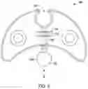 Fig. 09 - Methods for attaching acetabular augments together or to acetabular shells