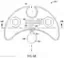Fig. 10 - Methods for attaching acetabular augments together or to acetabular shells
