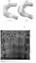 Fig. 02 - TISSUE ENGINEERING MENISCAL COMPOSITE SCAFFOLD AND PREPARATION METHOD THEREOF