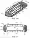 Fig. 43 - Intervertebral spinal implant