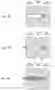 Fig. 06 - Apparatus, systems, and methods for the fixation or fusion of bone
