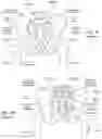 Fig. 08 - Apparatus, systems, and methods for the fixation or fusion of bone