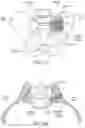 Fig. 10 - Apparatus, systems, and methods for the fixation or fusion of bone