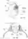 Fig. 14 - Apparatus, systems, and methods for the fixation or fusion of bone