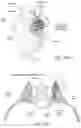 Fig. 16 - Apparatus, systems, and methods for the fixation or fusion of bone