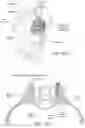 Fig. 19 - Apparatus, systems, and methods for the fixation or fusion of bone