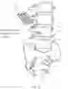 Fig. 29 - Apparatus, systems, and methods for the fixation or fusion of bone