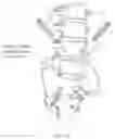 Fig. 35 - Apparatus, systems, and methods for the fixation or fusion of bone