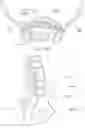 Fig. 41 - Apparatus, systems, and methods for the fixation or fusion of bone