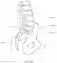 Fig. 43 - Apparatus, systems, and methods for the fixation or fusion of bone
