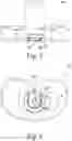 Fig. 06 - Method of trialing an orthopaedic prosthetic assembly