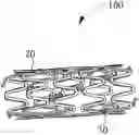 Fig. 01 - Absorbable metal stent