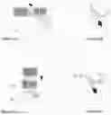 Fig. 06 - Devices and method for bruxism management