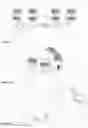 Fig. 08 - Devices and method for bruxism management