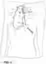 Fig. 02 - Systems and methods for treating eye diseases
