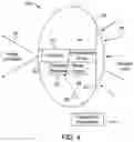 Fig. 05 - Intraocular implant device method