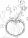 Fig. 07 - Intraocular implant device method
