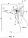 Fig. 08 - Intraocular implant device method