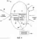 Fig. 05 - Artificial vision intraocular implant device