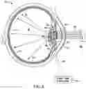 Fig. 06 - Artificial vision intraocular implant device