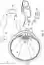 Fig. 19 - Artificial vision intraocular implant device