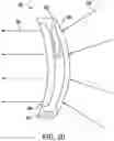 Fig. 22 - Artificial vision intraocular implant device