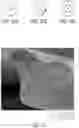 Fig. 20 - Nonwoven webs with one or more repeat units