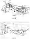 Fig. 06 - Head plate provided for an operating table and adjustable with one hand