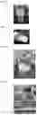Fig. 02 - COMPOSITION CONTAINING POWDER