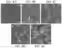 Fig. 07 - Method for treating neoplasms using hollow silica spheres