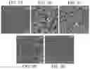 Fig. 08 - Method for treating neoplasms using hollow silica spheres
