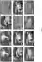 Fig. 14 - Twin-screw dry granulation for producing solid formulations