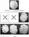 Fig. 16 - Twin-screw dry granulation for producing solid formulations