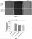 Fig. 28 - METHODS AND COMPOSITIONS FOR TREATING CANCER USING EXOSOMES-ASSOCIATED GENE EDITING