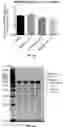 Fig. 29 - METHODS AND COMPOSITIONS FOR TREATING CANCER USING EXOSOMES-ASSOCIATED GENE EDITING