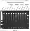 Fig. 32 - METHODS AND COMPOSITIONS FOR TREATING CANCER USING EXOSOMES-ASSOCIATED GENE EDITING