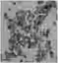 Fig. 01 - Surface-modified mesoporous silica nanoparticle for blood-brain barrier penetration,tumor targeting and cancer metastasis treatment, methods of production and uses thereof