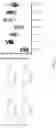 Fig. 06 - Mitofusin activators and methods of use thereof