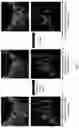 Fig. 11 - Mitofusin activators and methods of use thereof