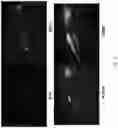 Fig. 04 - Methods and agents that enhance myogenic progenitor cell engraftment