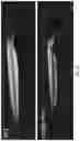 Fig. 33 - Methods and agents that enhance myogenic progenitor cell engraftment