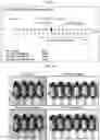 Fig. 02 - Composition compromising dunnione as effective ingredient for prevention or alleviation of hair loss