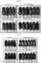 Fig. 03 - Composition compromising dunnione as effective ingredient for prevention or alleviation of hair loss