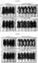 Fig. 04 - Composition compromising dunnione as effective ingredient for prevention or alleviation of hair loss