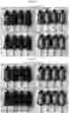 Fig. 06 - Composition compromising dunnione as effective ingredient for prevention or alleviation of hair loss